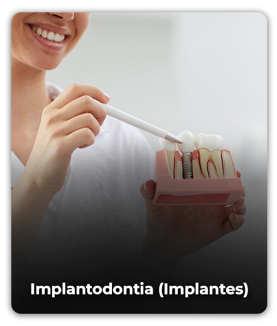 implantodontia
